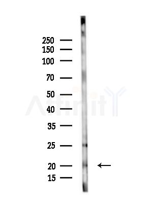 LMO4 Antibody - Western blot analysis of lysates from Rat liver, using LMO4 Antibody at 1/1000 dilution.