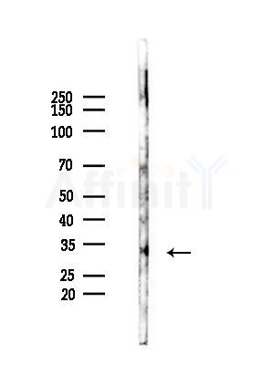 PITX1 Antibody - Western blot analysis of lysates from EC304 cells(heat-shock,45min treatment), using PITX1 Antibody at 1/1000 dilution.