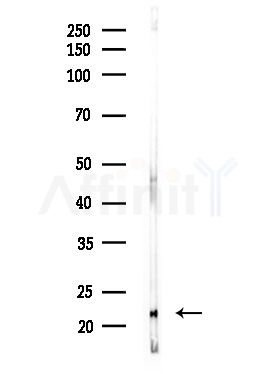 SFRS3 Antibody - Western blot analysis of lysates from MDA-MB-231 cells(heat-shock,45min treatment), using SFRS3 Antibody at 1/1000 dilution.