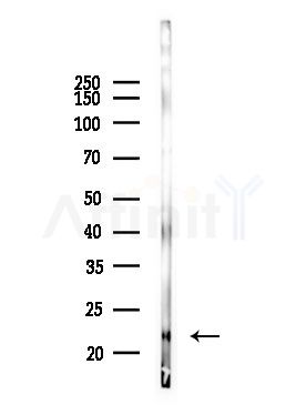 SFRS3 Antibody - Western blot analysis of lysates from Mouse lung, using SFRS3 Antibody at 1/1000 dilution.