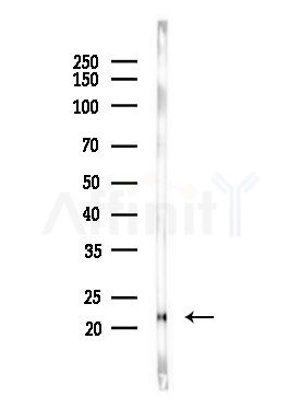 SFRS3 Antibody - Western blot analysis of lysates from LoVo cells(heat-shock,45min treatment), using SFRS3 Antibody at 1/1000 dilution.