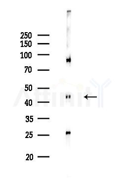 CDKL1 Antibody - Western blot analysis of lysates from MCF7 cells(heat-shock,45min treatment), using CDKL1 Antibody at 1/1000 dilution.