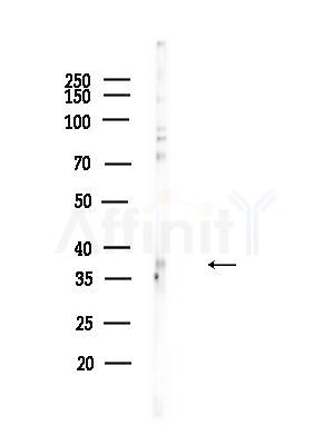 MEF2B Antibody - Western blot analysis of lysates from EC304 cells, using MEF2B Antibody at 1/1000 dilution.