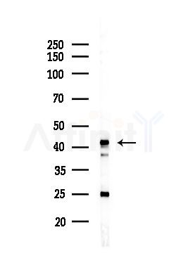 MVK Antibody - Western blot analysis of lysates from Hela cells(heat-shock,45min treatment), using MVK Antibody at 1/1000 dilution.