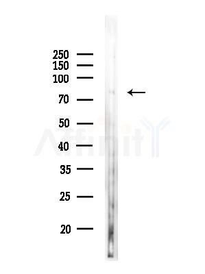 NCBP1 Antibody - Western blot analysis of lysates from COLO205 cells(heat-shock,45min treatment), using NCBP1 Antibody at 1/1000 dilution.