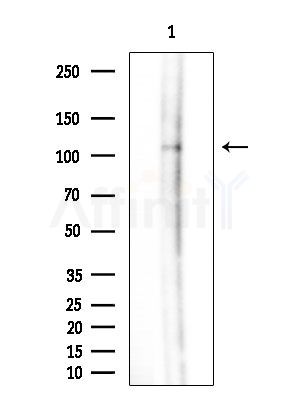 MN1 Antibody - Western blot analysis of extracts from 3T3-L1 cells(LPS  4h treatment), using MN1 Antibody at 1/1000 dilution.