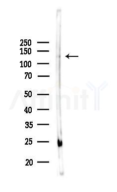 MN1 Antibody - Western blot analysis of lysates from 3T3-L1 P6(LPS, 4h treatment), using MN1 Antibody at 1/1000 dilution.