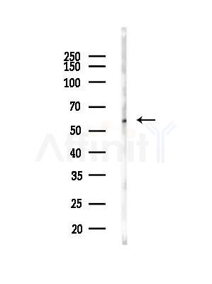 Nuclear Factor 1 Antibody - Western blot analysis of lysates from EC304 cells(heat-shock,45min treatment), using Nuclear Factor 1 Antibody at 1/1000 dilution.