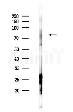 MTA1 Antibody - Western blot analysis of lysates from RAW264.