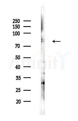 MTA1 Antibody - Western blot analysis of lysates from B16F10-LUC cells(heat-shock,45min treatment), using MTA1 Antibody at 1/1000 dilution.