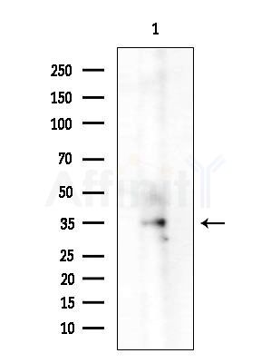 TUSC3 Antibody - Western blot analysis of extracts from 3T3-L1 cells(LPS  4h treatment), using TUSC3 Antibody at 1/1000 dilution.