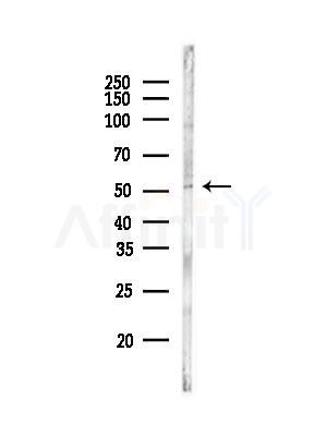 ITPK1 Antibody - Western blot analysis of lysates from A375 cells(LPS, 4h treatment), using ITPK1 Antibody at 1/1000 dilution.