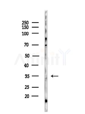 TNAP1 Antibody - Western blot analysis of lysates from PC12 cells(starvation,24h treatment), using TNAP1 Antibody at 1/1000 dilution.