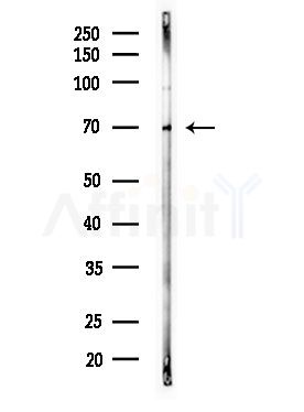 MELK Antibody - Western blot analysis of lysates from MDA-MB-231 cells(heat-shock,45min treatment), using MELK Antibody at 1/1000 dilution.