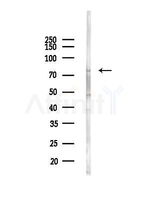 HLX1 Antibody - Western blot analysis of lysates from EC304 cells(heat-shock,45min treatment), using HLX1 Antibody at 1/1000 dilution.