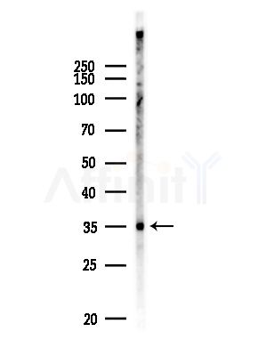 CDK5R1/P35 Antibody - Western blot analysis of lysates from MDA-MB-231 cells(heat-shock,45min treatment), using CDK5R1/P35 Antibody at 1/1000 dilution.