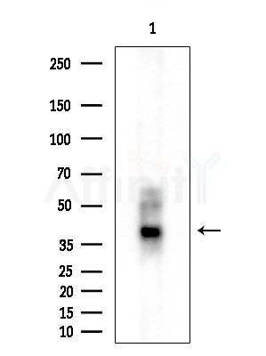 ANKRD1 Antibody - Western blot analysis of extracts from Rat lung, using ANKRD1 Antibody at 1/1000 dilution.