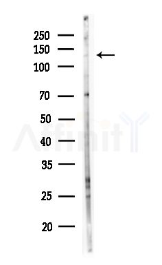 EPHA7 Antibody - Western blot analysis of lysates from MDA-MB-231 cells(heat-shock,45min treatment), using EPHA7 Antibody at 1/1000 dilution.