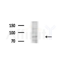 TAF5 Antibody - Western blot analysis of extracts from HepG2 cells(UV treatment), using TAF5 Antibody at 1/1000 dilution.