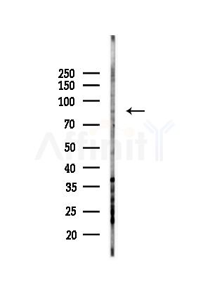 TAF5 Antibody - Western blot analysis of lysates from HepG2 cells(UV,30min treatment), using TAF5 Antibody at 1/1000 dilution.