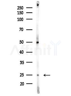 TSN Antibody - Western blot analysis of lysates from MDA-MB-231 cells(heat-shock,45min treatment), using TSN Antibody at 1/1000 dilution.
