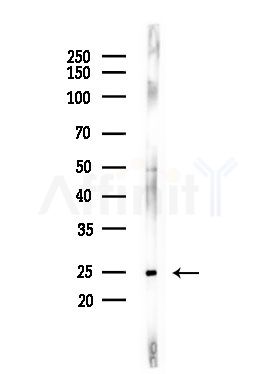 TSN Antibody - Western blot analysis of lysates from LoVo cells(heat-shock,45min treatment), using TSN Antibody at 1/1000 dilution.