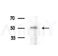 TRIP13 Antibody - Western blot analysis of extracts from HUVEC cells(starvation treatment), using TRIP13 Antibody at 1/1000 dilution.