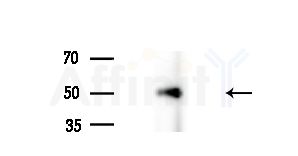 TRIP13 Antibody - Western blot analysis of extracts from Rat brain, using TRIP13 Antibody at 1/1000 dilution.