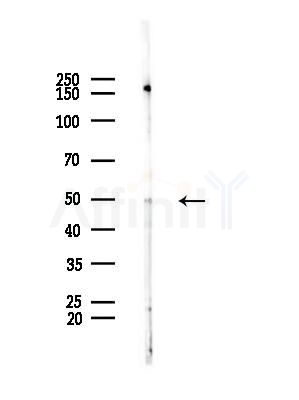 TRIP13 Antibody - Western blot analysis of lysates from HUVEC cells(starvation,24h treatment), using TRIP13 Antibody at 1/1000 dilution.