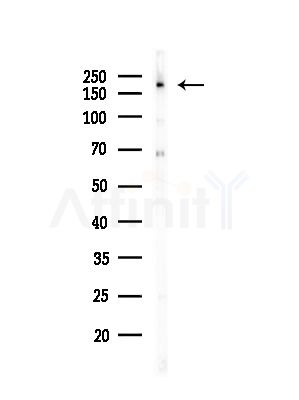 TRAP220/MED1 Antibody - Western blot analysis of lysates from Hela cells(starvation,24h treatment), using TRAP220/MED1 Antibody at 1/1000 dilution.