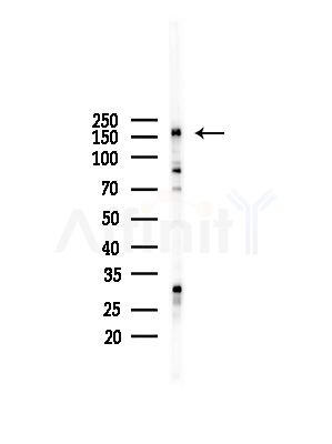 TRAP220/MED1 Antibody - Western blot analysis of lysates from LoVo cells(heat-shock,45min treatment), using TRAP220/MED1 Antibody at 1/1000 dilution.
