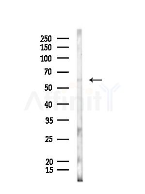 DOK7 Antibody - Western blot analysis of lysates from Rat liver, using DOK7 Antibody at 1/1000 dilution.