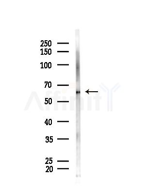 DOK7 Antibody - Western blot analysis of lysates from B16F10-LUC cells(starvation,24h treatment), using DOK7 Antibody at 1/1000 dilution.