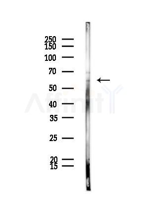 DOK7 Antibody - Western blot analysis of lysates from Rat brain, using DOK7 Antibody at 1/1000 dilution.