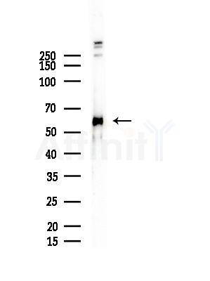DAK Antibody - Western blot analysis of lysates from COLO205 cells, using DAK Antibody at 1/1000 dilution.