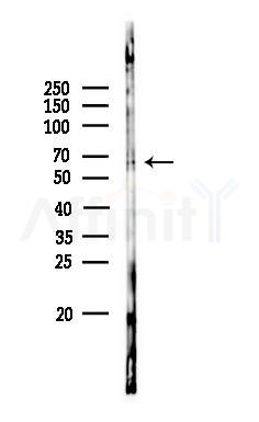 ADCK5 Antibody - Western blot analysis of lysates from Rat lung, using ADCK5 Antibody at 1/1000 dilution.