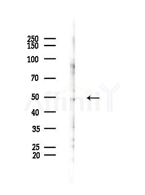 PLCH Antibody - Western blot analysis of lysates from HUVEC cells(starvation,24h treatment), using PLCH Antibody at 1/1000 dilution.