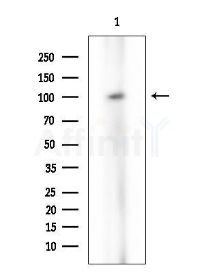FAKD1 Antibody - Western blot analysis of extracts from EC304 cells, using FAKD1 Antibody at 1/1000 dilution.