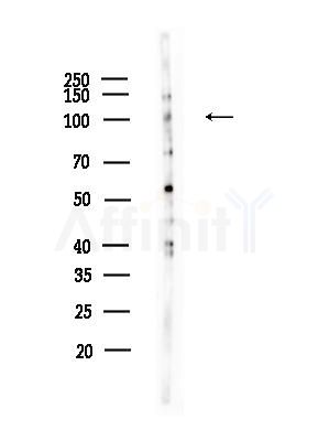 FAKD1 Antibody - Western blot analysis of lysates from EC304 cells, using FAKD1 Antibody at 1/1000 dilution.
