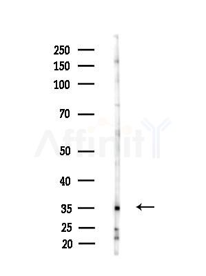 CDKL4 Antibody - Western blot analysis of lysates from A375 cells(heat-shock,45min treatment), using CDKL4 Antibody at 1/1000 dilution.