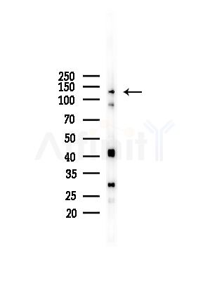 RBM26 Antibody - Western blot analysis of lysates from LoVo cells(heat-shock,45min treatment), using RBM26 Antibody at 1/1000 dilution.