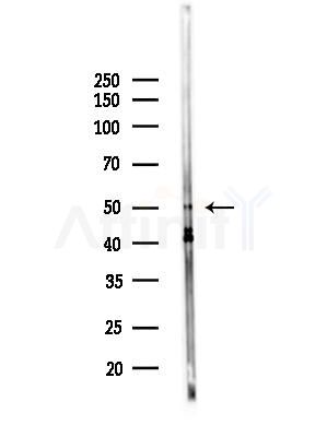 STEAP4 Antibody - Western blot analysis of lysates from Hela cells(UV,30 min treatment), using STEAP4 Antibody at 1/1000 dilution.