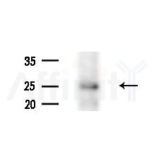 LDOC1L Antibody - Western blot analysis of extracts from B16F10-LUC cells(starvation treatment), using LDOC1L Antibody at 1/1000 dilution.