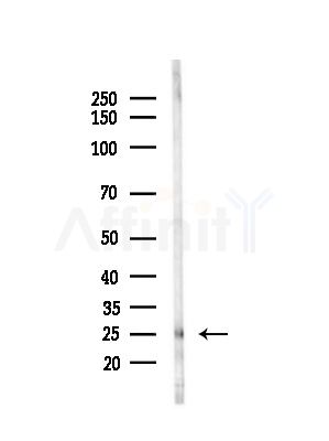 LDOC1L Antibody - Western blot analysis of lysates from B16F10-LUC cells(starvation,24h treatment), using LDOC1L Antibody at 1/1000 dilution.