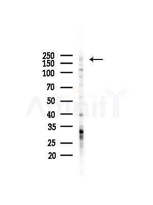 MAST2 Antibody - Western blot analysis of lysates from LoVo cells(heat-shock,45min treatment), using MAST2 Antibody at 1/1000 dilution.