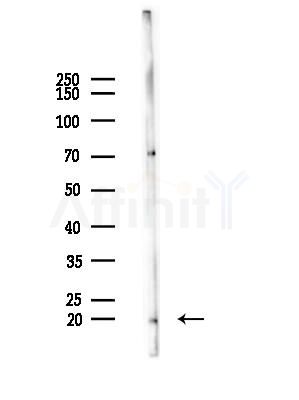 TNFAIP8L2 Antibody - Western blot analysis of lysates from A375 cells(heat-shock,45min treatment), using TNFAIP8L2 Antibody at 1/1000 dilution.