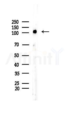 KSR2 Antibody - Western blot analysis of lysates from Rat brain, using KSR2 Antibody at 1/1000 dilution.