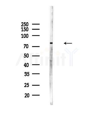 MARK2 Antibody - Western blot analysis of lysates from Hela cells(starvation,24h treatment), using MARK2 Antibody at 1/1000 dilution.