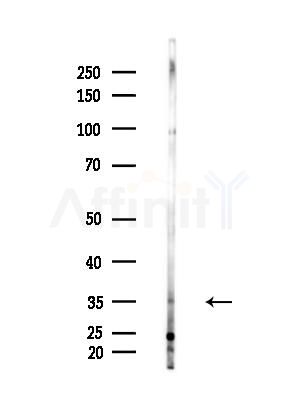 ATPBD3 Antibody - Western blot analysis of lysates from A375 cells(heat-shock,45min treatment), using ATPBD3 Antibody at 1/1000 dilution.