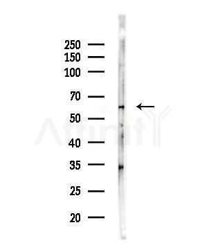 ADCK1 Antibody - Western blot analysis of lysates from HUVEC cells, using ADCK1 Antibody at 1/1000 dilution.